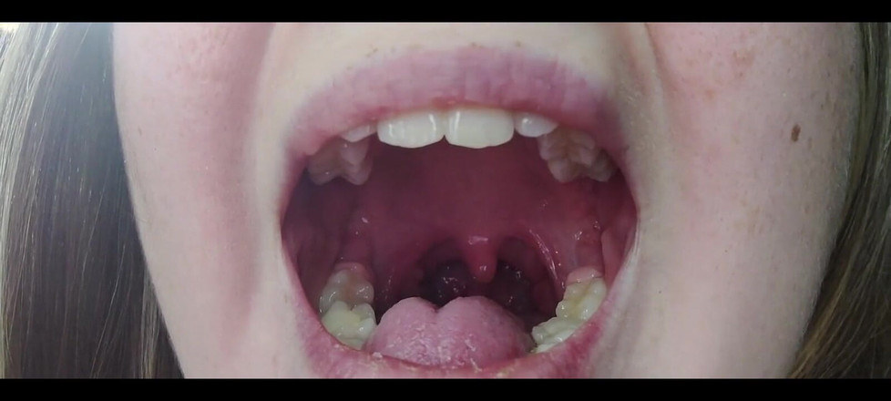 RavenHearth666VIP: Fetiș cu gât