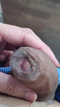 Meu Penis Molhado De Semen