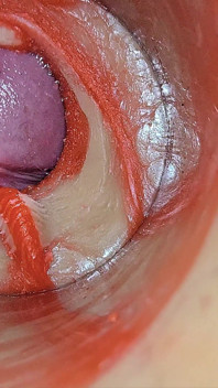 Inseminação feminina - câmera interna captura ejaculação enorme do macho profundo