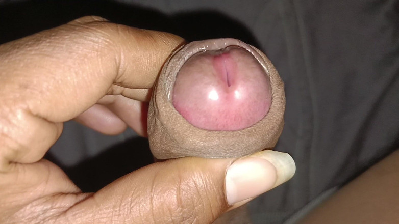 pikuviral: Lelaki itu menembak zakarnya dan dikongkek