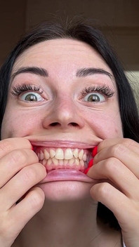 Mouth Stretching & Big Eyes