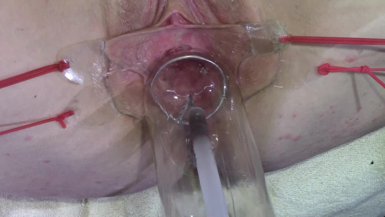 deep keely: 11 Lan truyền rộng rãi Âm hộ Cận cảnh chết tiệt...