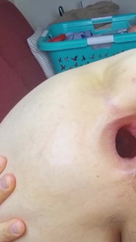ของเล่นยักษ์ มือทั้งกำ รูตูดยื่นออกมา และรูตูดอ้าบานสุดๆ!