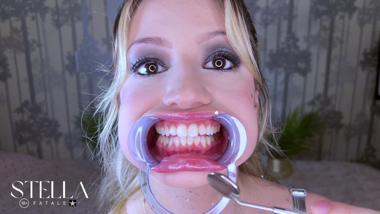 Stellafatale: Dente fetiche extremo close-up exame odontológico