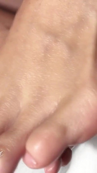 Oily Feet