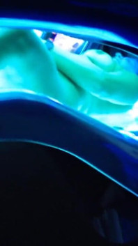 On the sunbed