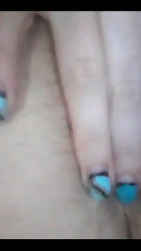 Cận cảnh âm hộ