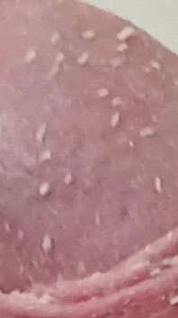 Smegma Foreskin Roll. bigpisser
