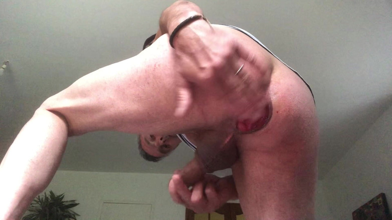 Jardinsecret346: Simplicity Anal Prolapse