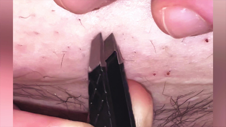 SatisfyingDillyDally: Mijzelf beukend