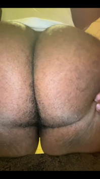 Bite Me