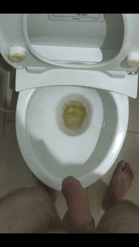 Morning Pee