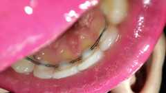 Princess18_: Prohlídka pusy permanentních ponechačů