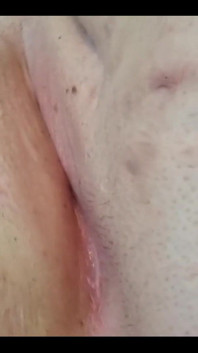 Cheeky Starfish Wink untuk Kalian Semua