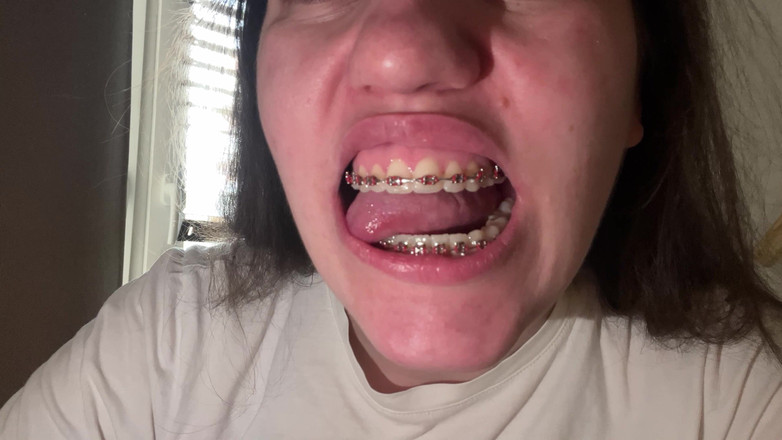 NicoleRay: Лизати брекети язиком