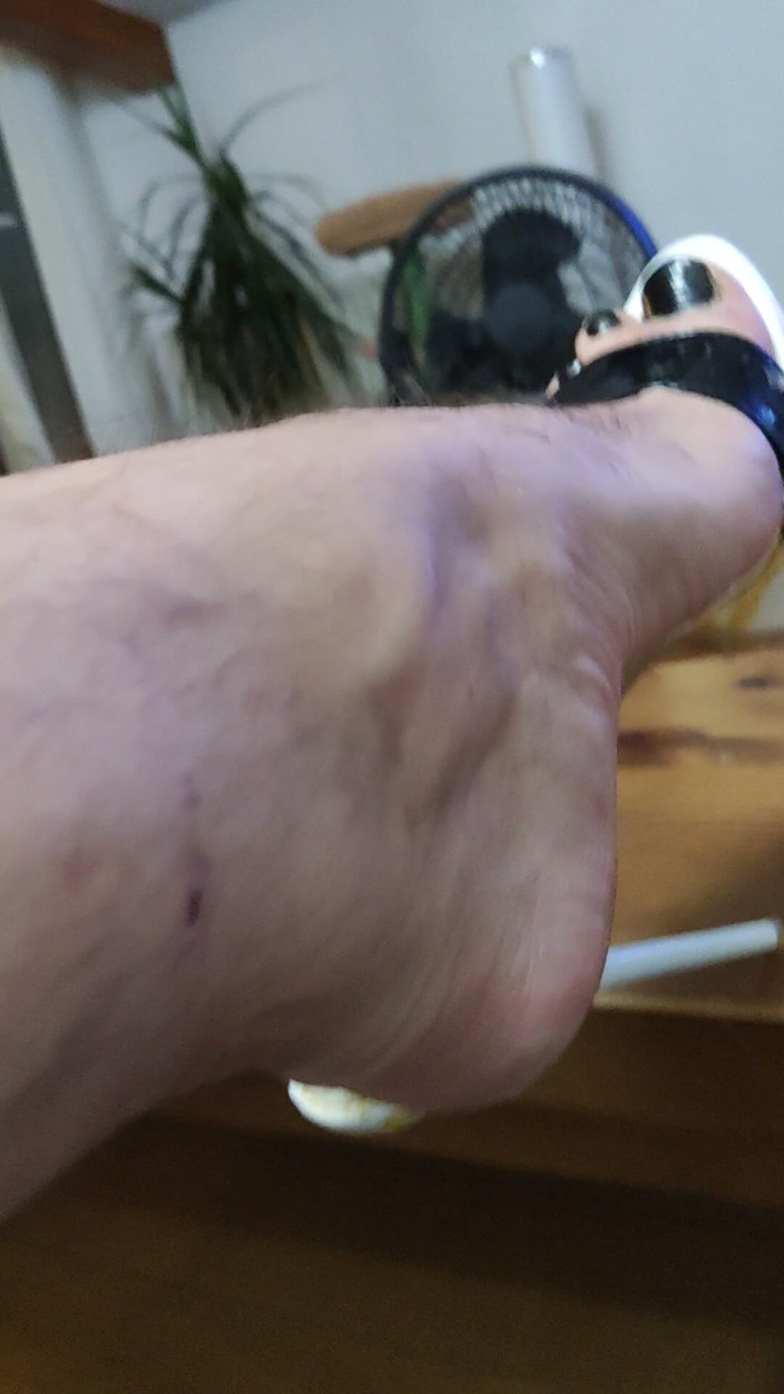 Mutsakin: Watch My Heels