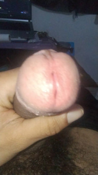 Smegma Big Uncut Smell