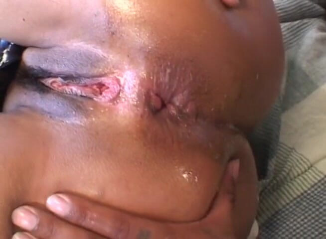 Analiscius: Busty ebony wearing latex gloves gets her ass hole fucked