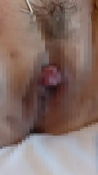 M女クリトリスを吸引してゴムで固定します
