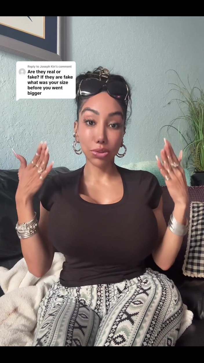 Anakaliyah: Je veux juste partager certains de mes trucs de chirurgie...
