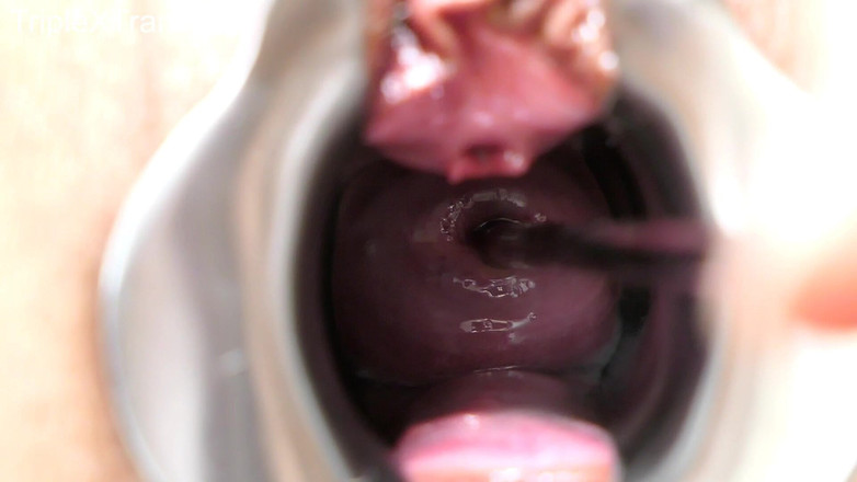 TripleXTransMan: मेरी गर्भाशय ग्रीवा में घुसना!