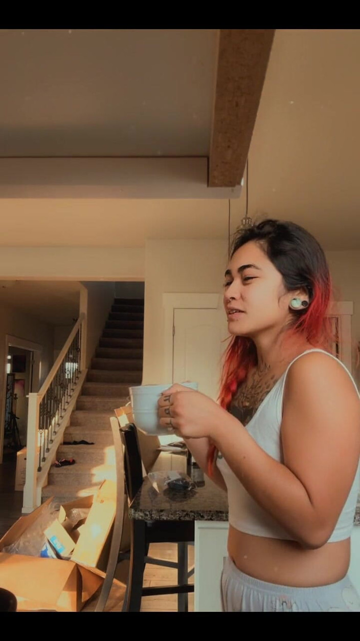 lilRavenFox: Omg a Long Lil Update My Foot Is Healing!