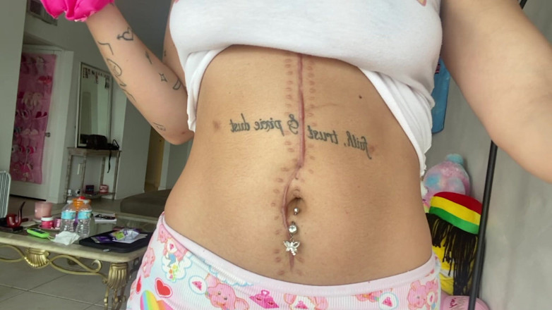 Nali Marie: Littekenfetisj navel taille buik magere tiener tengere platte buik bochtig