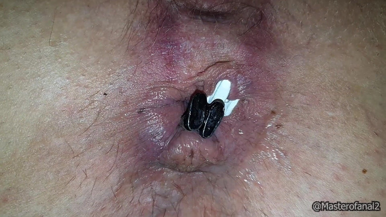 Violet Buttercup: Giantess Anal and Pussy - Speculum and Farting