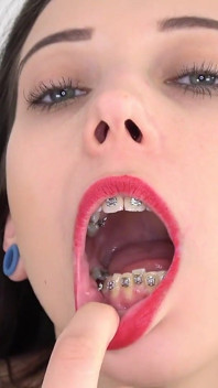 Video fetish della bocca con Bara che mostra l'apparecchio dentale.