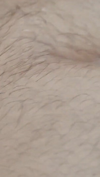 Penis tânăr cu fimoză care stă în calea încărcăturii.