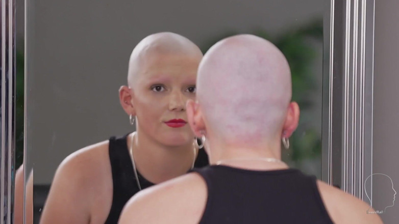 Euro Bald: Lea 2