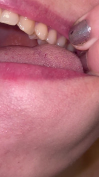 Mouth Tour No Makeup Teeth Tongue Uvula Tonsils Check