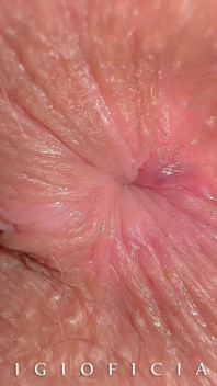 Bagaimana kalau kita merekam lubang pantat gadis 18 tahun - close up?