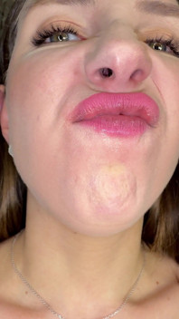 Mouth Secrets: Thick White Coating on My Tongue