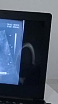 Gynecologist Performs Ultrasound Differently Next to the Cuckold