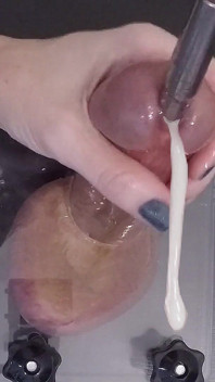 Das Löschen der Harnröhre führt zu einem üppigen Spermafluss