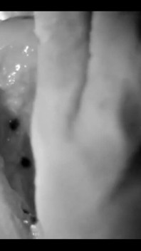 My Hands Destroying Fruit, Part Two