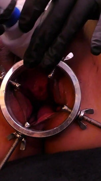 Speculum & Microcamera for Lady Soniac