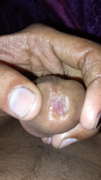 Penis Massage