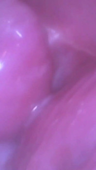 Asian Angel 28004