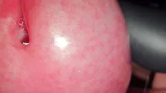 Microscopic Close up on My Penis