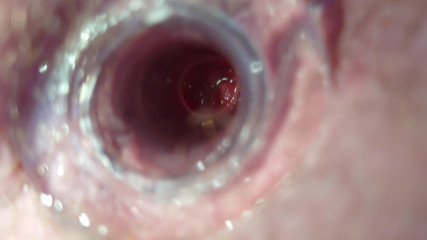 Carmen_Nylonjunge: Tes Kecil dengan Terowongan Anal