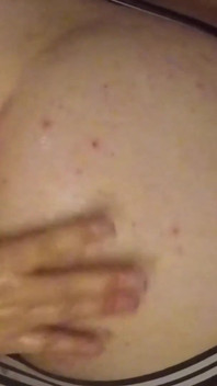 Große Anale Dilatation Und Riesiger Dildo Mit Meiner Frau