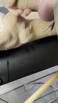 The Lollipop Couldn’t Handle the Pressure