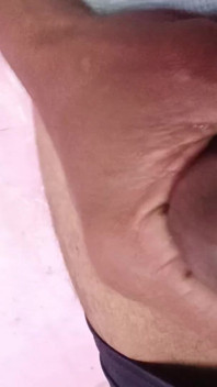 Small Penis