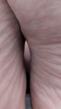 Wrinckles