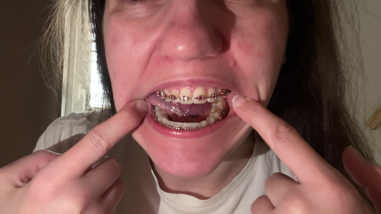 NicoleRay: Olizování rovnátek jazykem