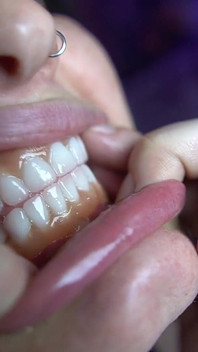 Tour pela boca com dentaduras