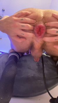 Huge Gape