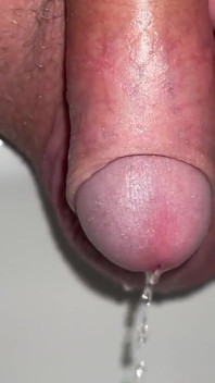 Kencing dan bermain dengan Forskin